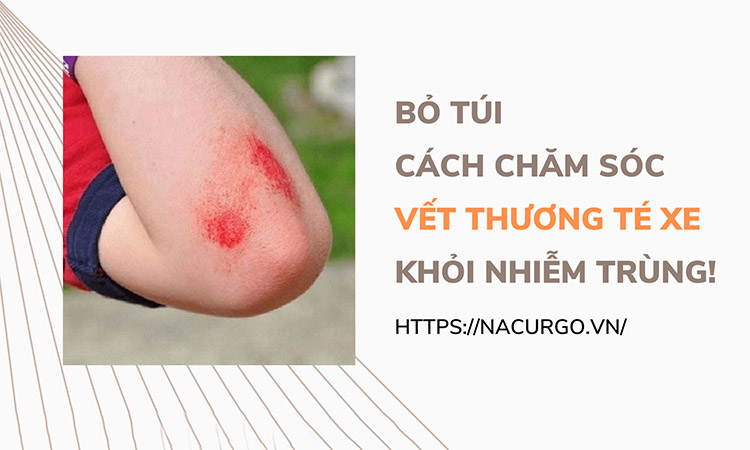Té Xe Trầy Xước: Hướng Dẫn Sơ Cứu và Chăm Sóc Vết Thương Gallery 2