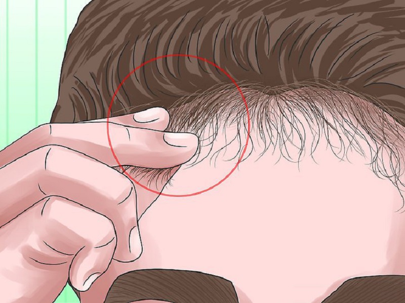 Chân Tóc Bị Xoăn Ở Gốc: Nguyên Nhân và Cách Khắc Phục