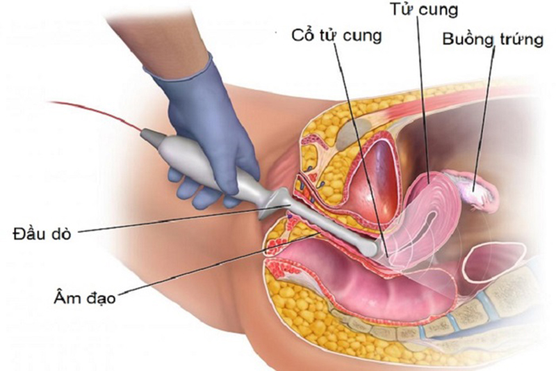 Siêu Âm Đầu Giò Gallery 1