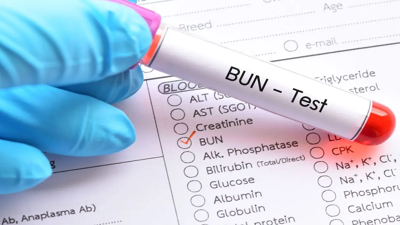 Chỉ số Ure là gì?