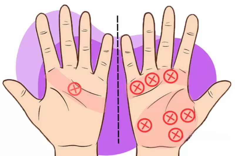 Chỉ Tay Dấu X: Ý Nghĩa Và Cách Sử Dụng