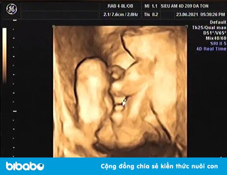 Chim Non Mọc Muộn: Nguyên Nhân và Cách Khắc Phục