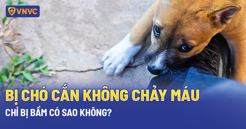 Chó cắn không chảy máu có sao không?