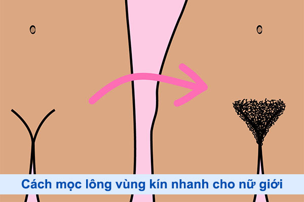 Lông vùng kín rậm phải làm sao? Gallery 2