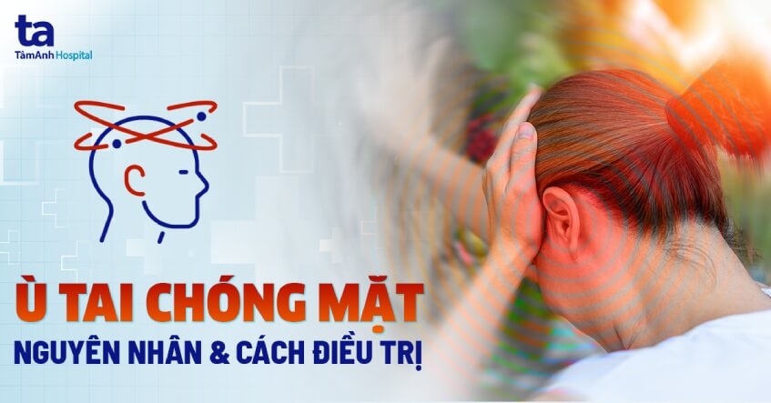 Chóng Mặt Ù Tai