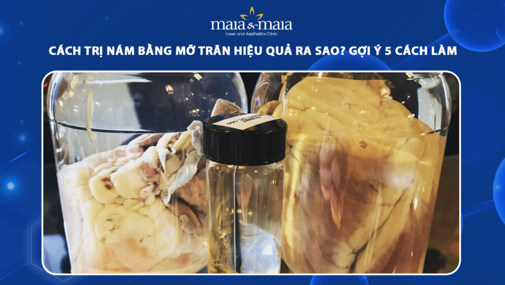 Cách Lấy Mỡ Trăn Hiệu Quả Và An Toàn Gallery 1