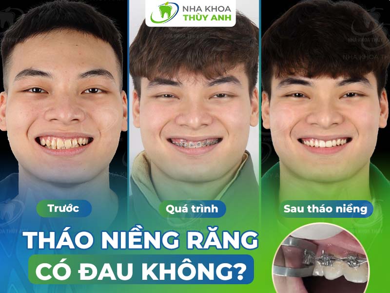 Tháo: Nghệ thuật tháo gỡ, sửa chữa và bảo dưỡng thiết bị Gallery 1