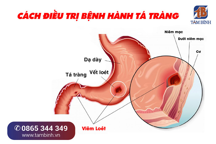 Hành Tá Tràng Nằm Ở Đâu? Gallery 2