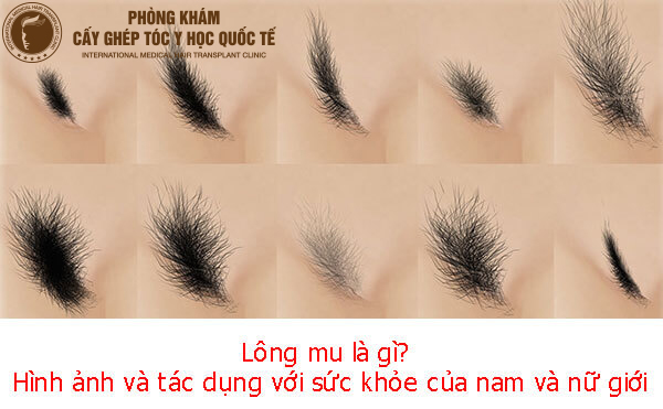 Lông mu là gì? Gallery 1