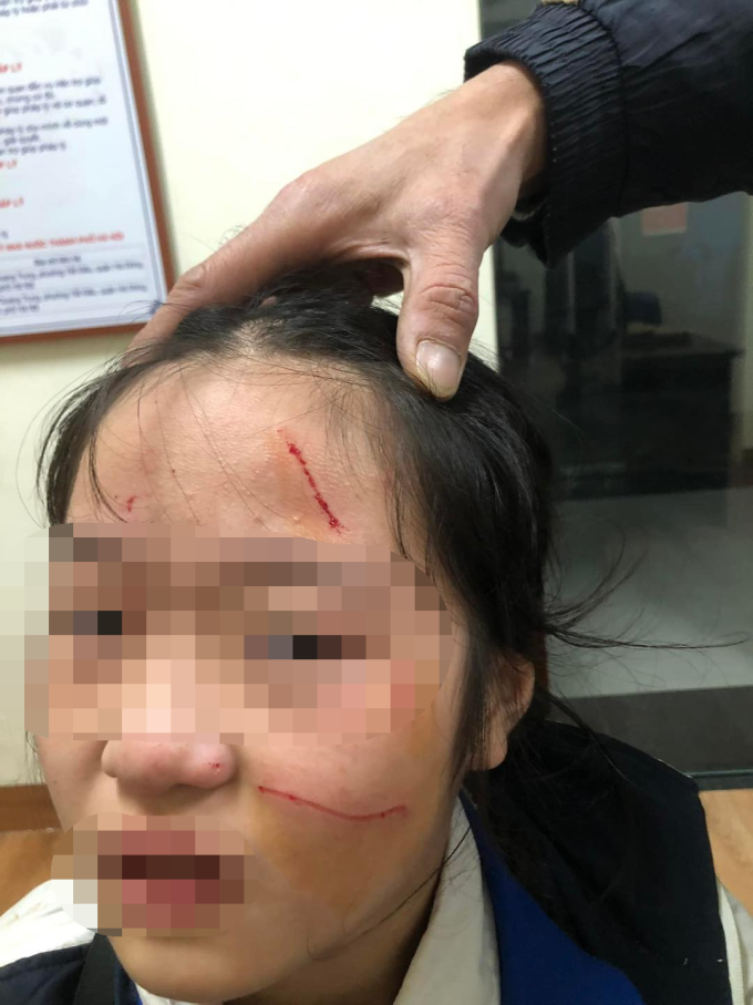 Cô bạn cùng lớp trên mình đầy vết thương: Nguyên nhân và cách giúp đỡ Gallery 1