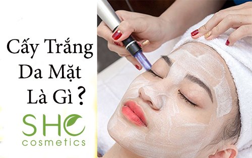 Cấy trắng da mặt là gì? Gallery 1
