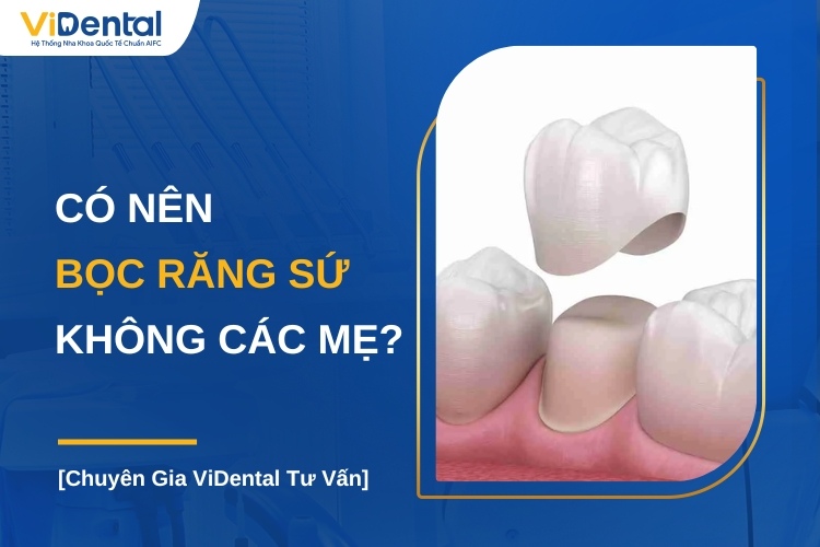 Có Nên Bọc Răng Sứ Không Các Mẹ?