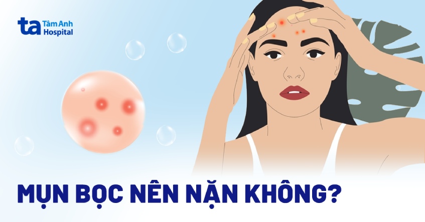 Có Nên Nặn Mụn Bọc?