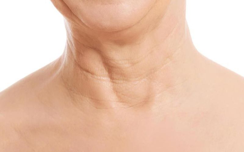 Cổ Nhiều Ngấn Quấn Vòng