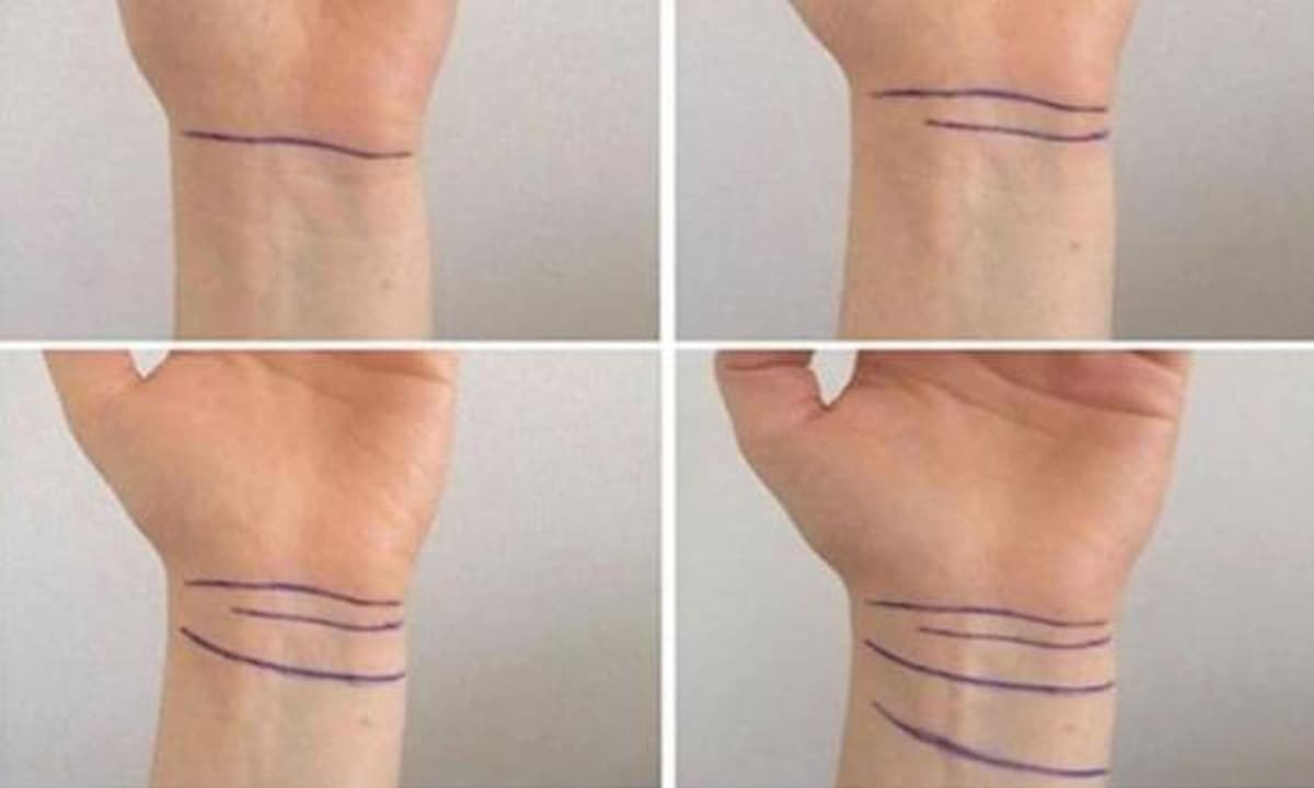 Cổ Tay Có 3 Ngấn: Bí Quyết Sức Khỏe và Vẻ Đẹp