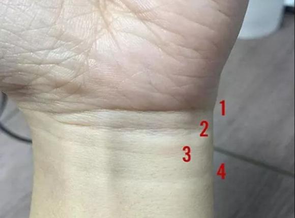 Cổ Tay Có 3 Ngấn: Bí Quyết Sức Khỏe và Vẻ Đẹp Gallery 2
