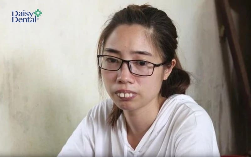 Con gái răng hô có xấu không?