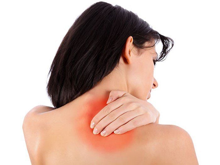 Cứng Cổ Vai Gáy: Nguyên Nhân, Triệu Chứng và Cách Điều Trị