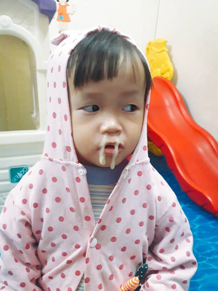 Cười Chảy Nước Mũi: Nguyên Nhân, Cách Khắc Phục và Những Điều Cần Biết