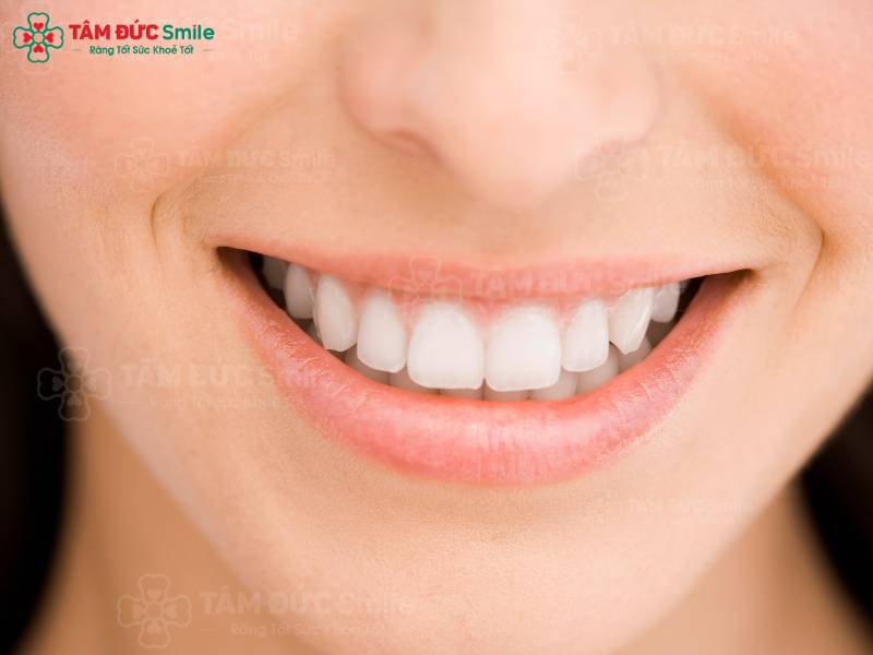 Cười hở 10 cái răng
