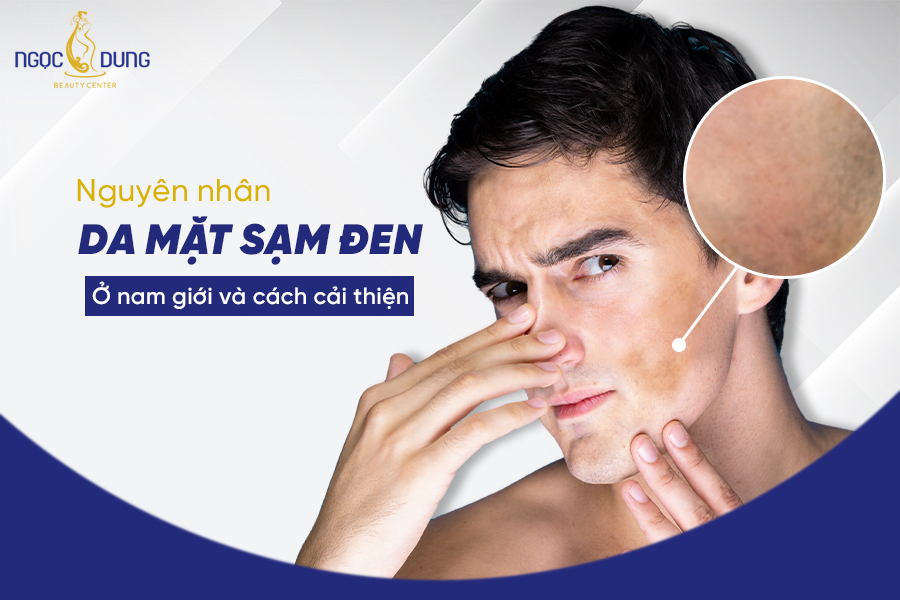 Da Mặt Sạm Đen Ở Nam Giới: Nguyên Nhân Và Cách Khắc Phục