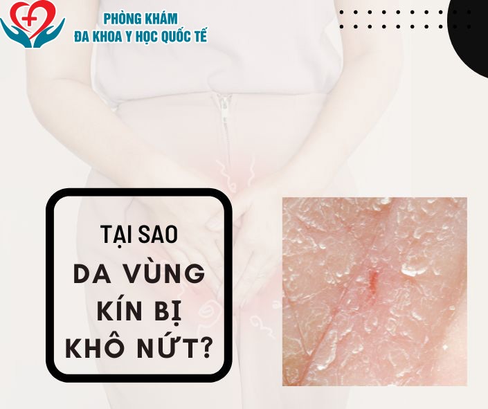 Da vùng kín bị khô nứt: Nguyên nhân, triệu chứng và cách điều trị