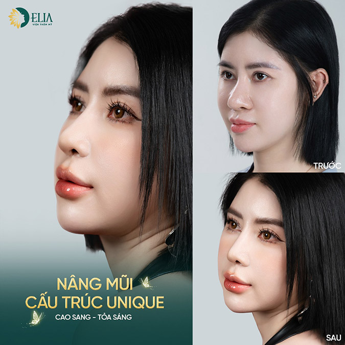 Cánh Mũi Dày Đầu Mũi Tròn: Phân Tích Hình Dáng Và Cách Trang Điểm Phù Hợp Gallery 1