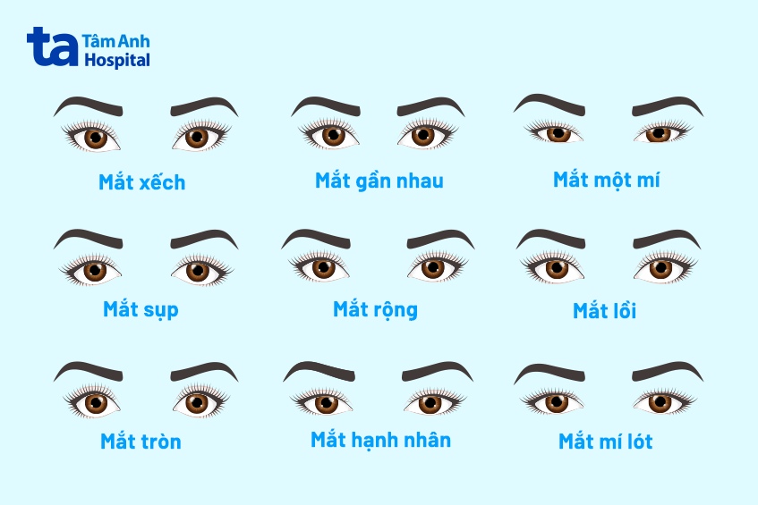 Mắt Díu Là Gì? Gallery 1