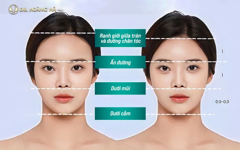 Người Trán Cao: Đặc Điểm, Tính Cách Và Những Điều Thú Vị Gallery 1