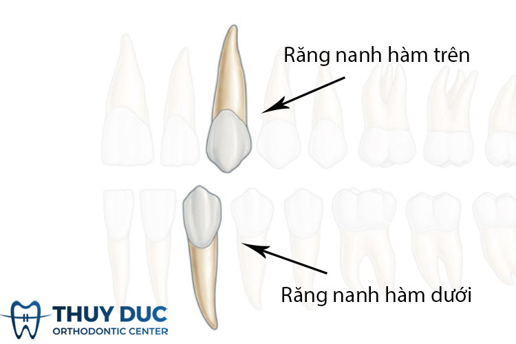 Răng Nanh Ở Người: Chức Năng, Đặc Điểm Và Những Vấn Đề Thường Gặp Gallery 2