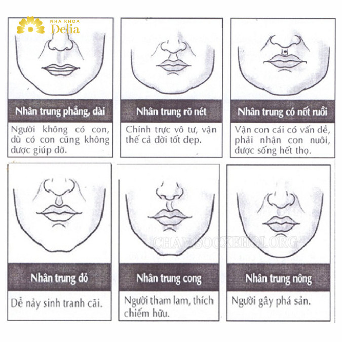 Trung Đường Là Gì? Gallery 2
