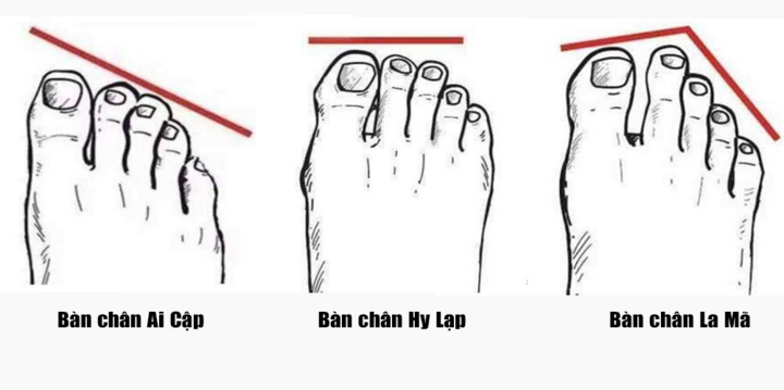 Bàn chân Hy Lạp nói lên điều gì? Gallery 1