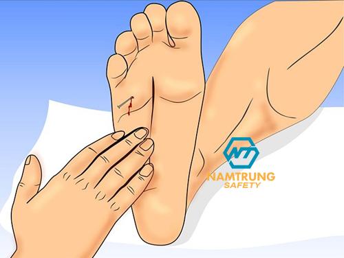 Dẫm đinh thì phải làm sao?