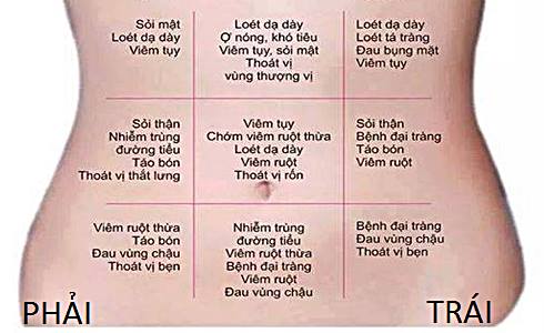 Đau Bụng Dưới Rốn: Nguyên Nhân, Triệu Chứng và Cách Xử Trí