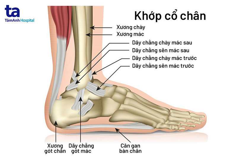 Đau Dây Chằng Cổ Chân: Nguyên Nhân, Triệu Chứng Và Điều Trị