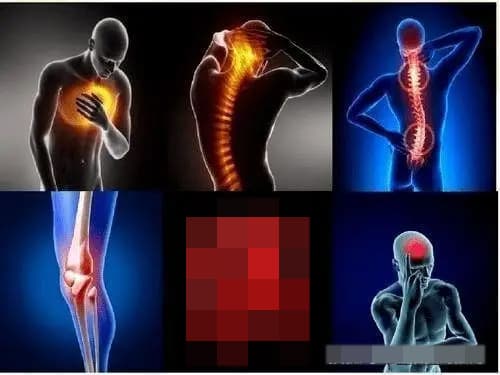Đau đớn là gì? Gallery 2