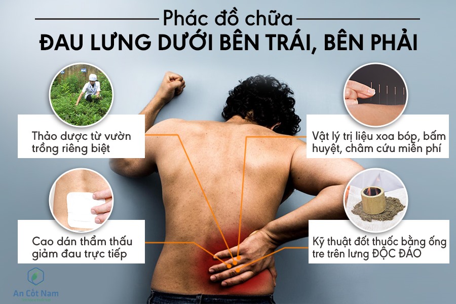 Đau lưng dưới bên trái: Nguyên nhân và cách khắc phục