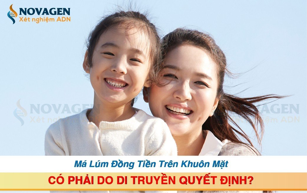 Làm sao để con có má lúm đồng tiền? Gallery 1