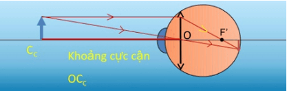 Điểm cực cận và điểm cực viễn là gì?
