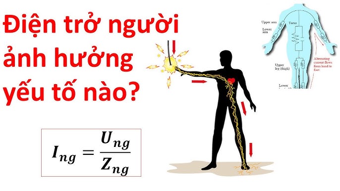 Điện trở của người