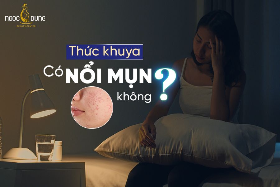 Cách thức khuya không nổi mụn Gallery 2