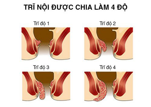 Nóng Rát Hậu Môn Sau Khi Đại Tiện Gallery 2