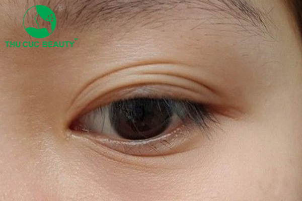 Đượm buồn là gì?