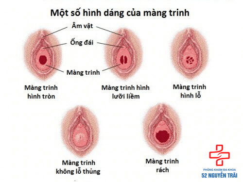 Đút tay vào có mất trinh không?
