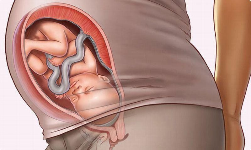 Em Bé Quay Đầu Mẹ Có Bị Đau Bụng Không?
