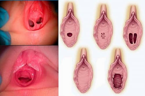 Gái còn trinh có mùi đặc trưng?