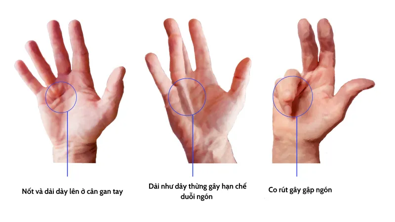 Gấp rút là gì? Gallery 2