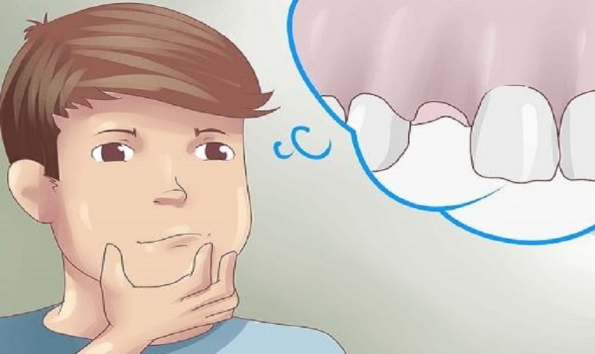 Giấc mơ bị gãy răng báo hiệu điều gì? Giải mã giấc mơ gãy răng chi tiết