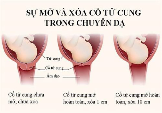 Quy Trình Đỡ Đẻ Thường Gallery 1