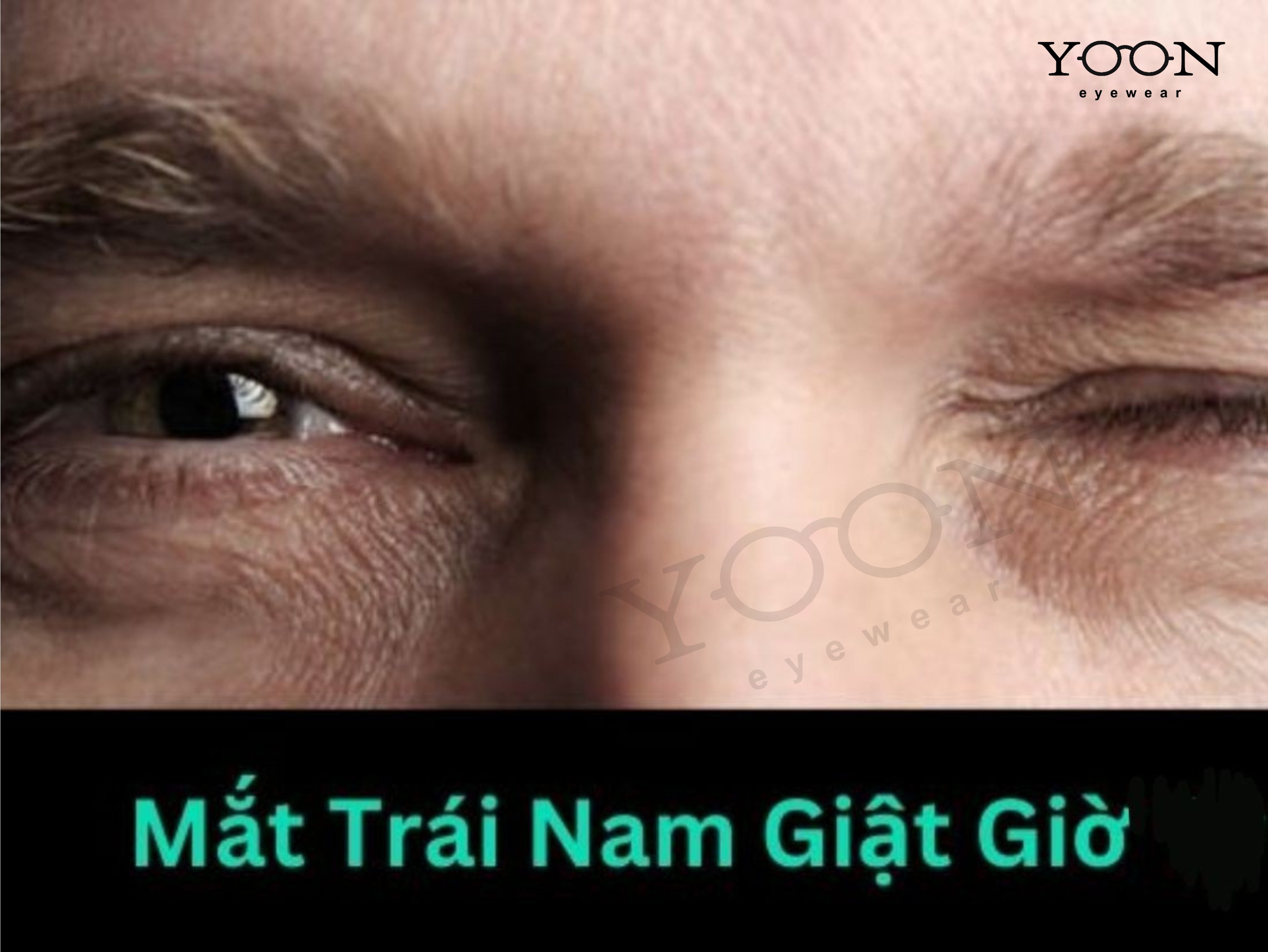 Mắt Trái Nam Giật Có Điềm Gì? Gallery 1